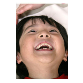 小児歯科